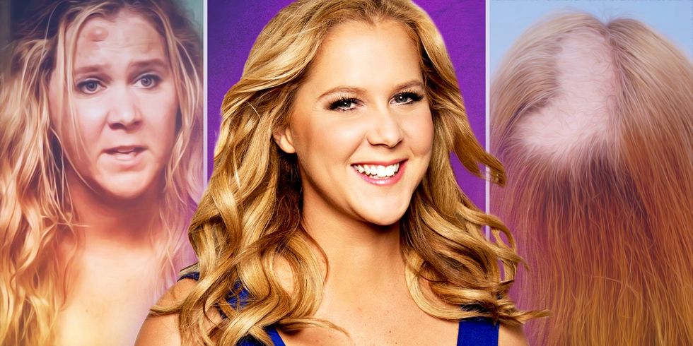 Amy Schumer's Secret Disorder - And Why Revealing It Now Is So Important