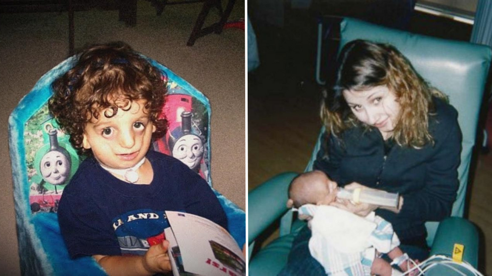 Parents Horrified to See Newborn Son’s Face - Years Later, He Becomes Famous