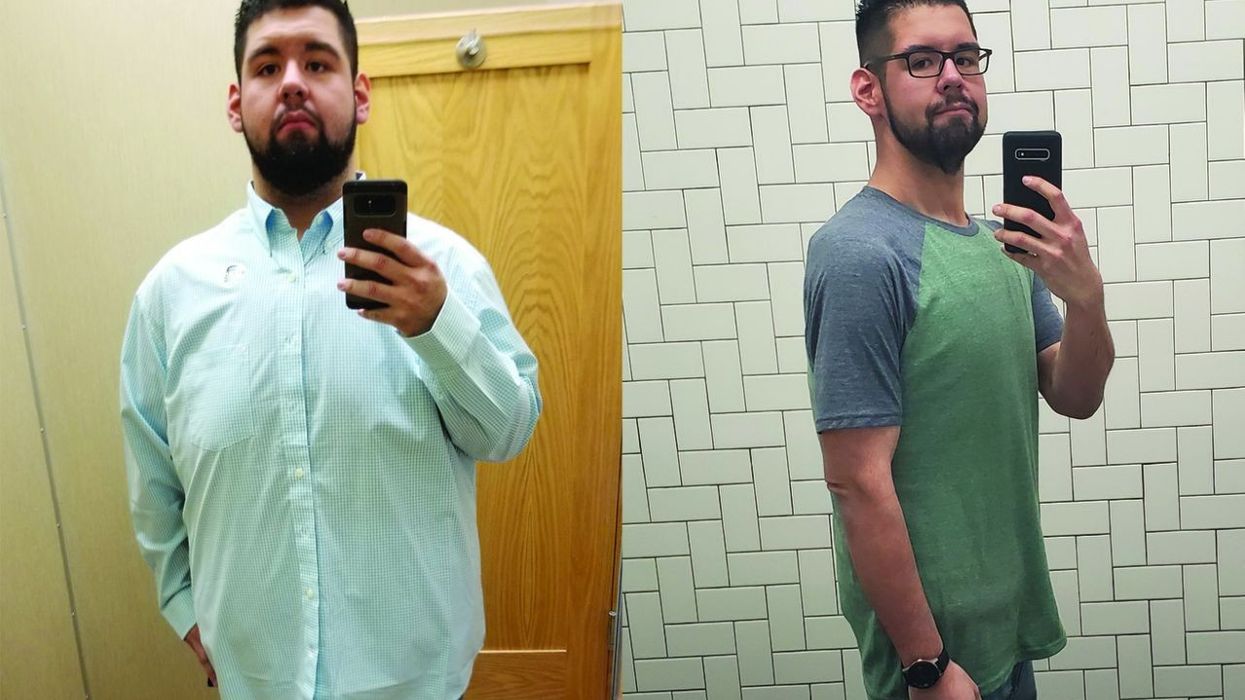 Determined Man Loses 331 Pounds to Save His Heart After Health Scare