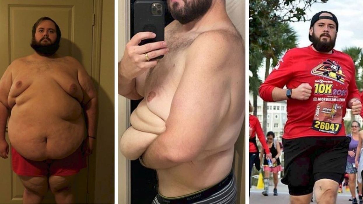 3 Years Ago, He Weighed 465 lbs But When He Met The Love Of His Life, Everything Changed