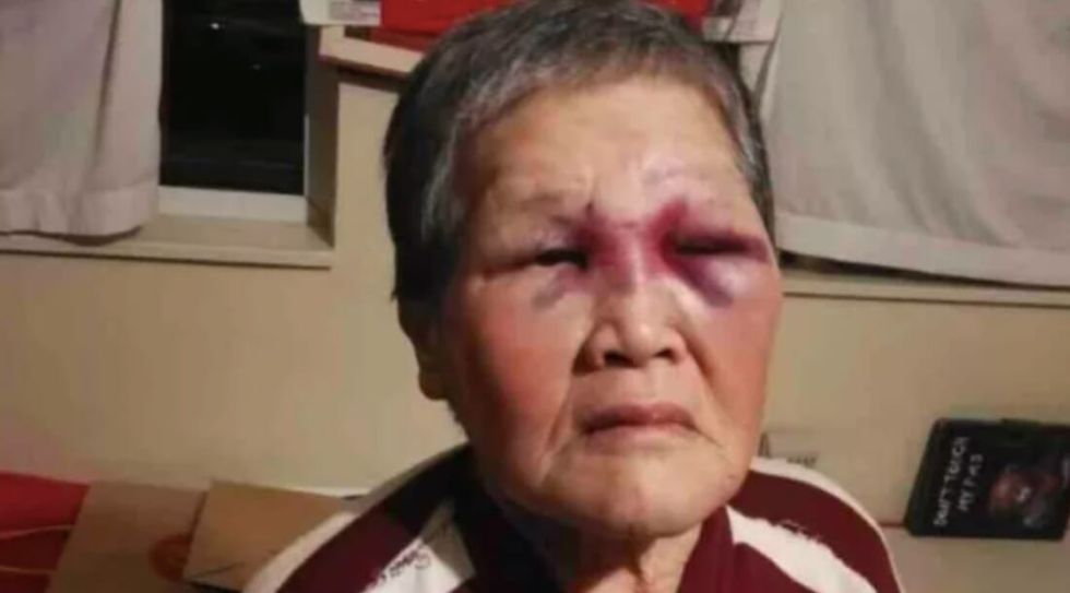 Elderly woman sends racist attacker hospital 1100x610