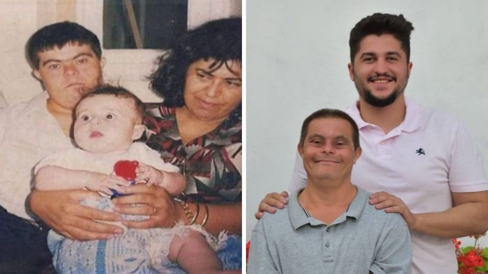 “I Was Raised by a Father With Down Syndrome” - Student Dentist Celebrates Dad by Destroying Stereotypes
