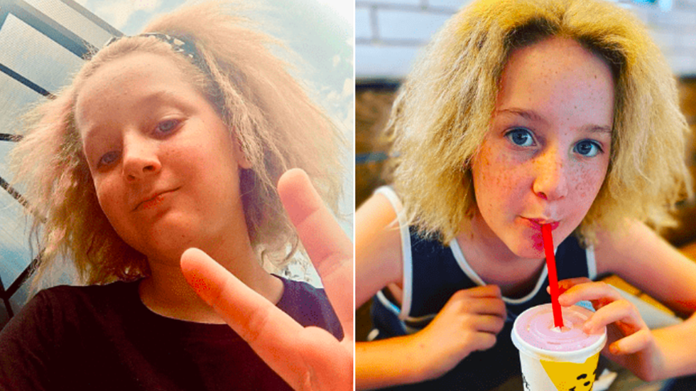 "Love What Makes You Different:" 12-Year-Old Girl Fully Embraces Her Genetic 'Uncombable Hair Syndrome' (PHOTOS)