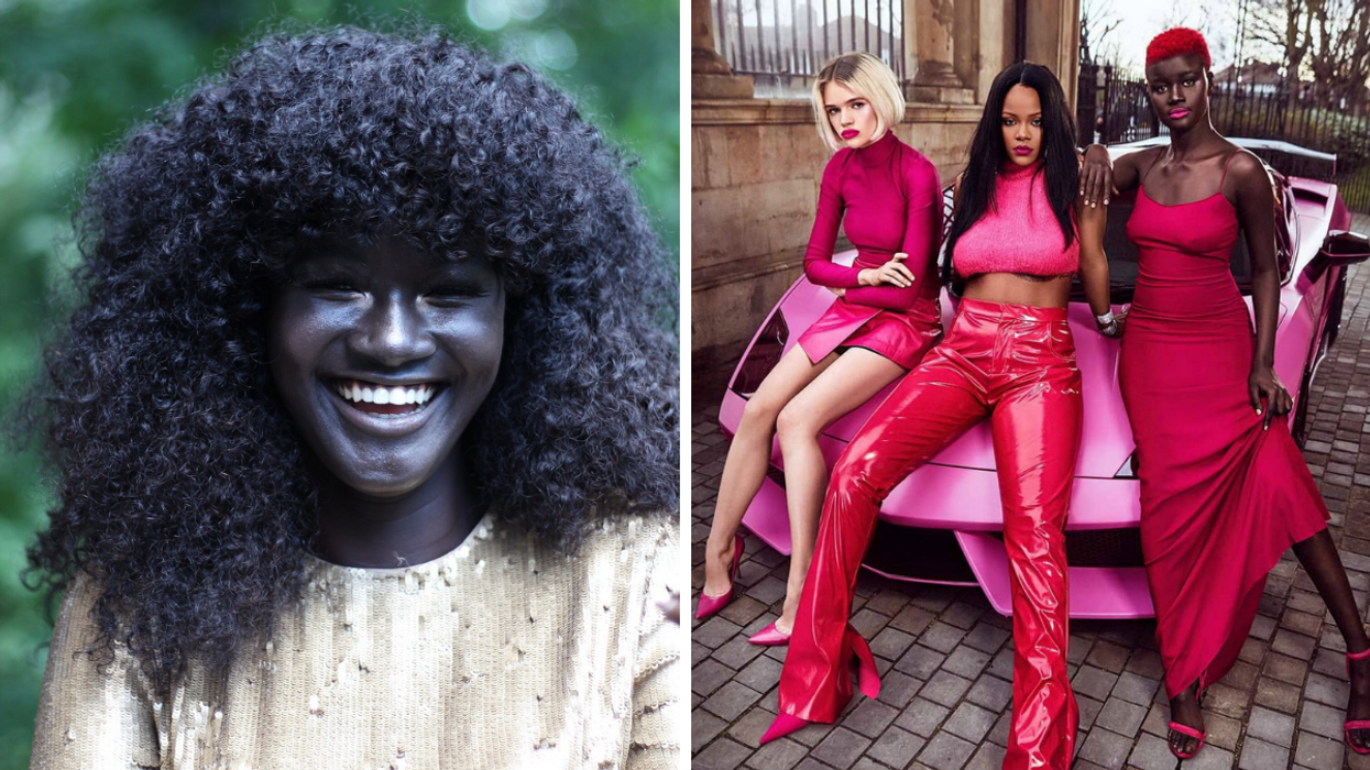 Bullied For Her Dark Skin, She Vows To Love Herself - Now She’s A High-Fashion Model