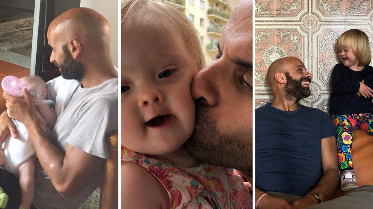 Single Dad Adopts Baby Girl With Down Syndrome Who Was Rejected By 20 Families