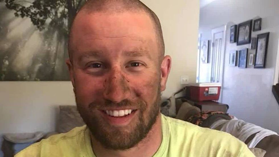 man with dirt on his face