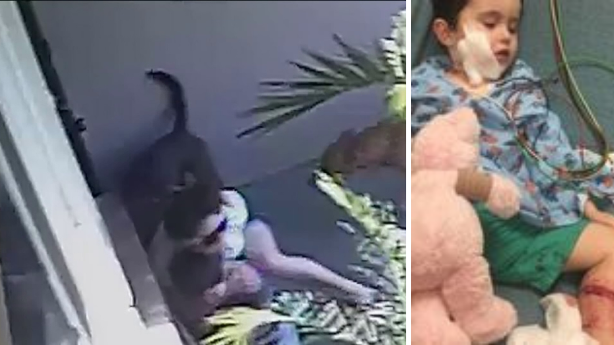 Aggressive Dogs Lunge At Two-Year Old Boy, Mom Acts As A Shield To Save His Life