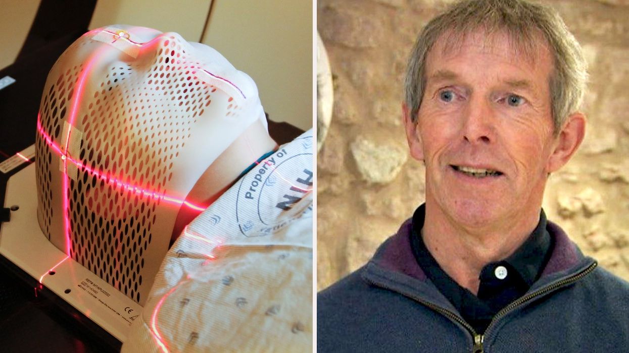 Revolutionary Parkinson’s Disease Treatment Reverses Symptoms - And That Could Change Everything