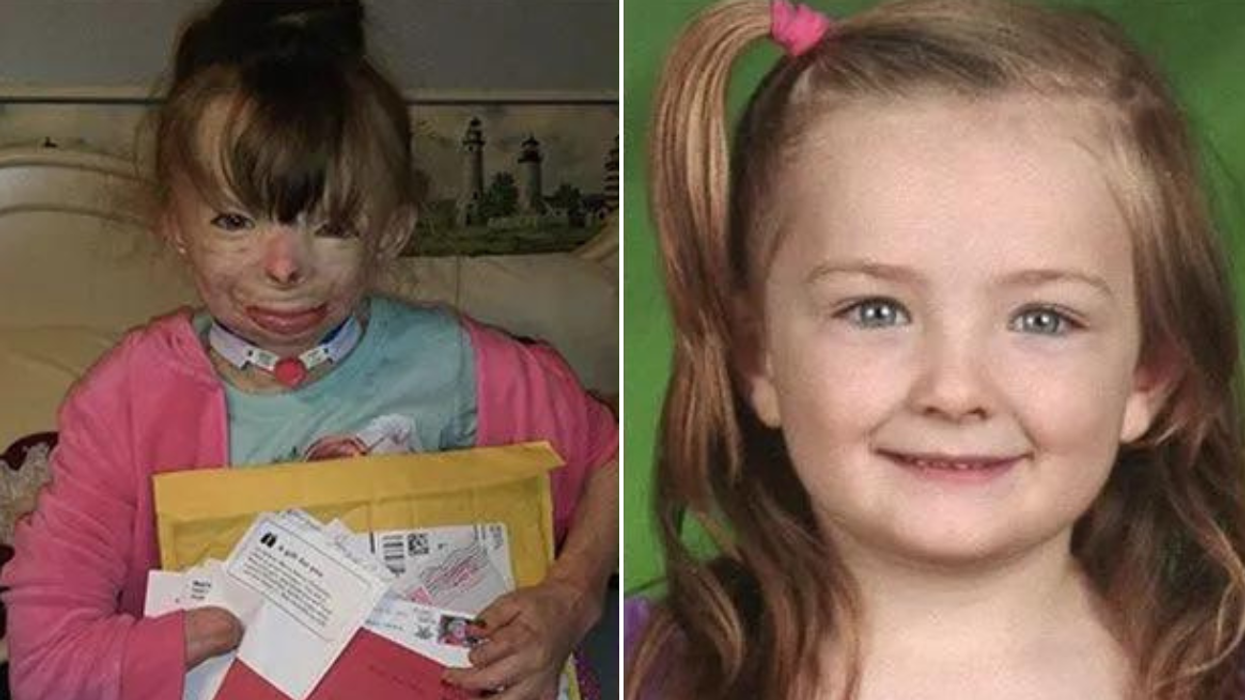 Little Girl Who Survived Fire Received More Than 700,000 Christmas Cards
