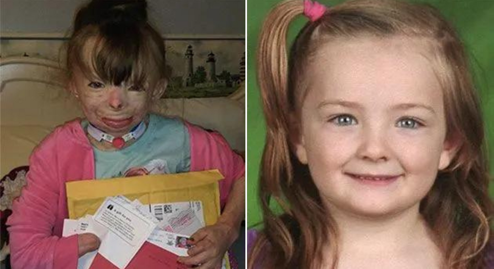 Little Girl Who Survived Fire Received More Than 700,000 Christmas Cards