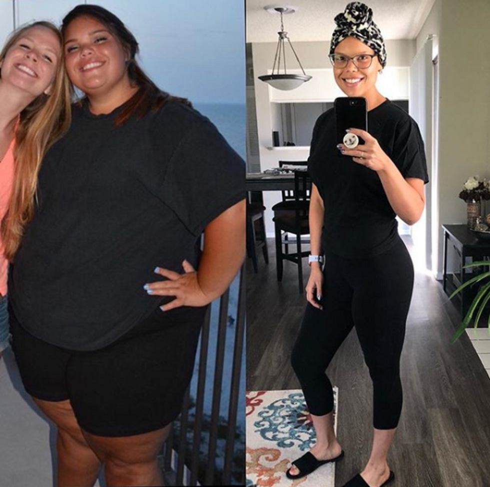 After Losing 170 Pounds, This Brave Woman Was Diagnosed With Cancer but Her Mindset Will Inspire You