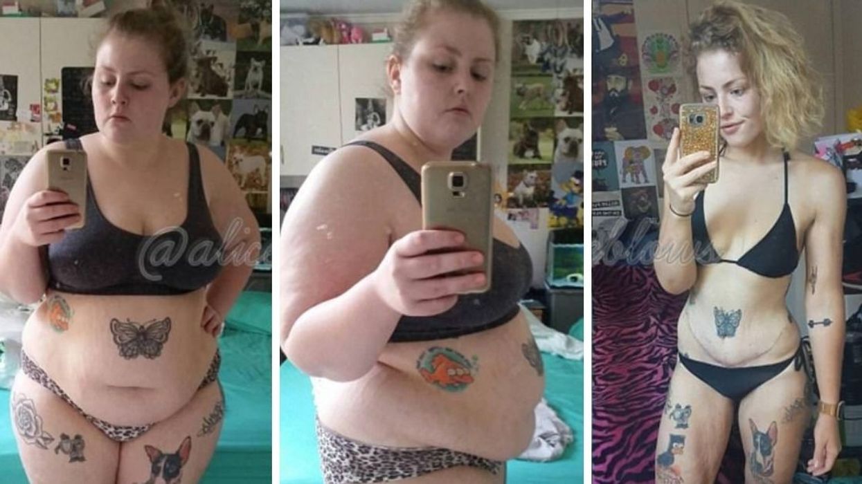 After Battling Food Addiction For Years, She Lost Over 150 Pounds By Adjusting Her Mindset