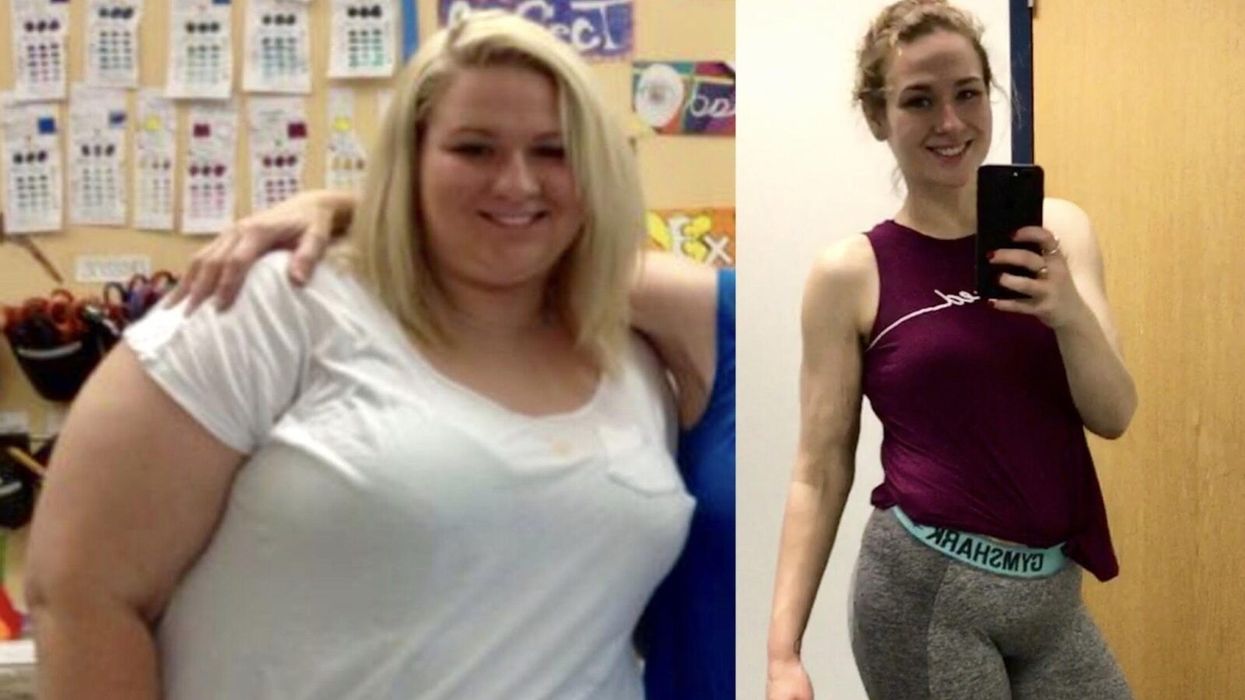 Woman Loses Over 200 Pounds After Medical Diagnosis, Blows Us Away With Her Perseverance