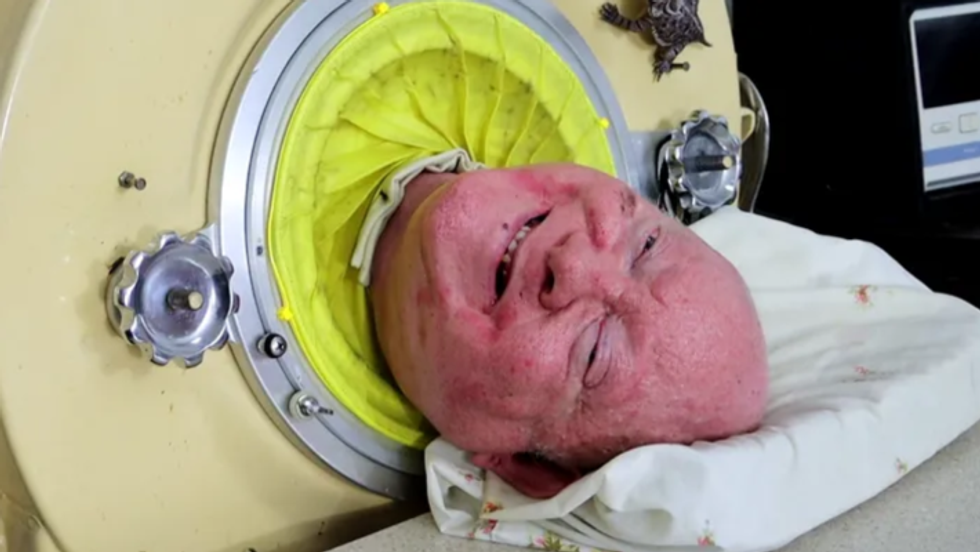 the man in the iron lung