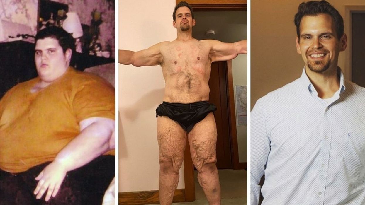 After Finding Out He Might Die, He Defied The Odds and Lost 600 Pounds