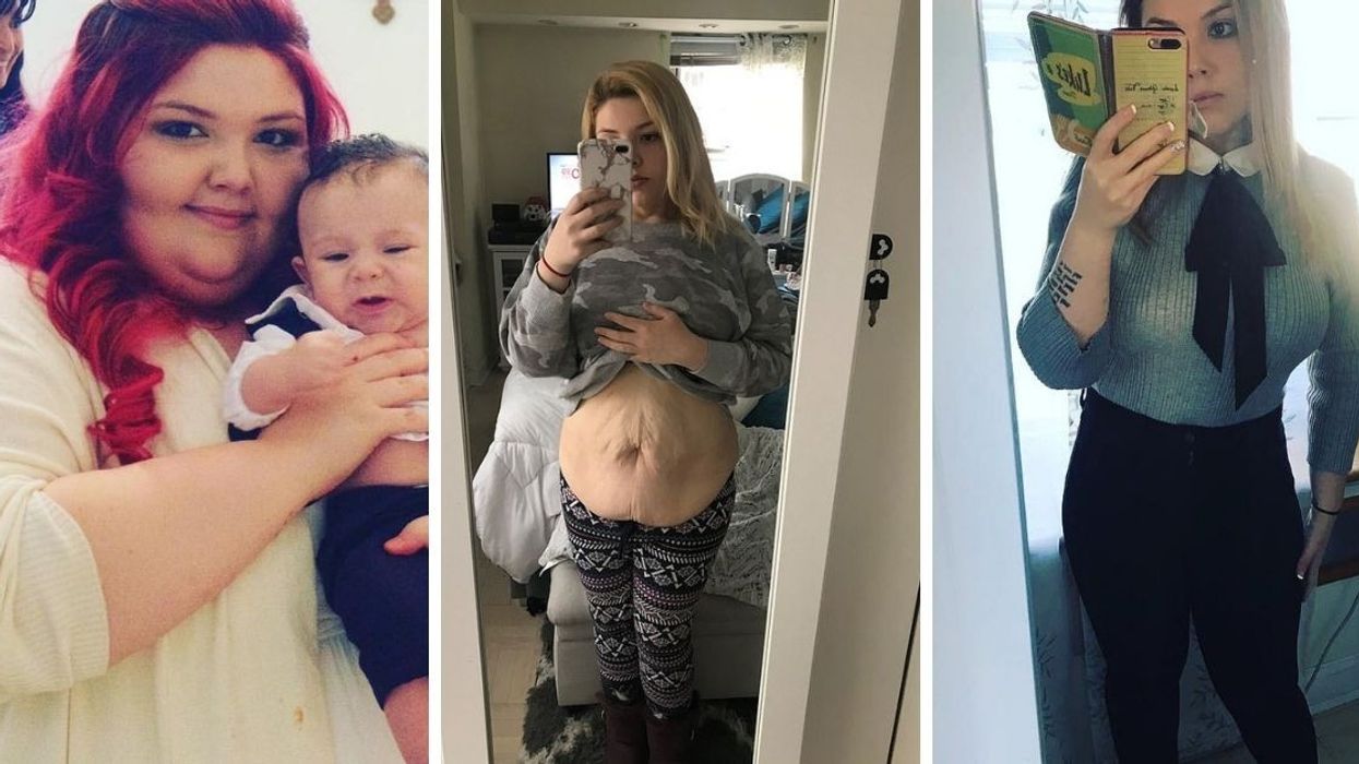 After Giving Birth, She Lost Nearly 250 Pounds So She Could Be A Better Mom