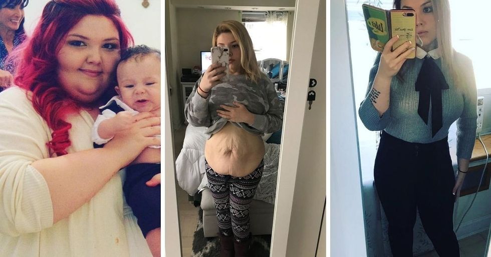 After Giving Birth, She Lost Nearly 250 Pounds So She Could Be A Better Mom