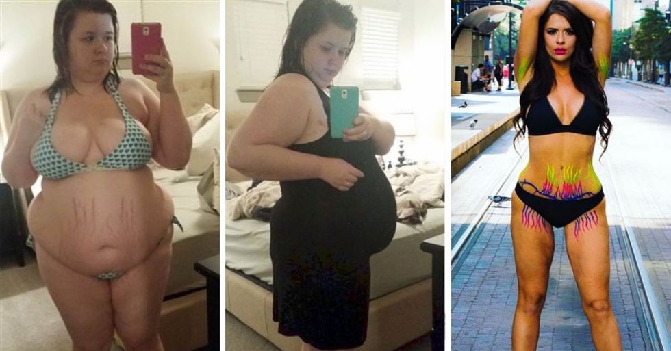 After Hitting Rock Bottom, She Lost Over 150 Pounds And Turned Her Life Around