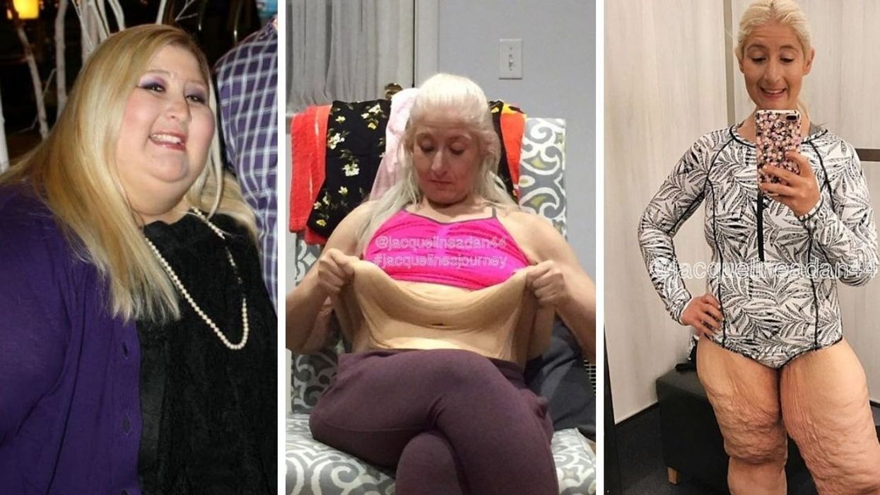After A Humiliating Experience, She Lost 350 Pounds And Defied All Her Bullies