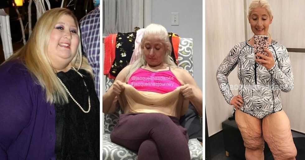 After A Humiliating Experience, She Lost 350 Pounds And Defied All Her Bullies
