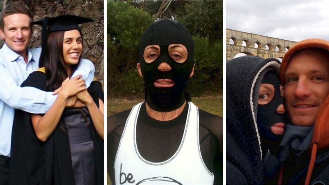 Turia Pitt Reveals Her Powerful Story of True Love After Surviving Deadly Fire