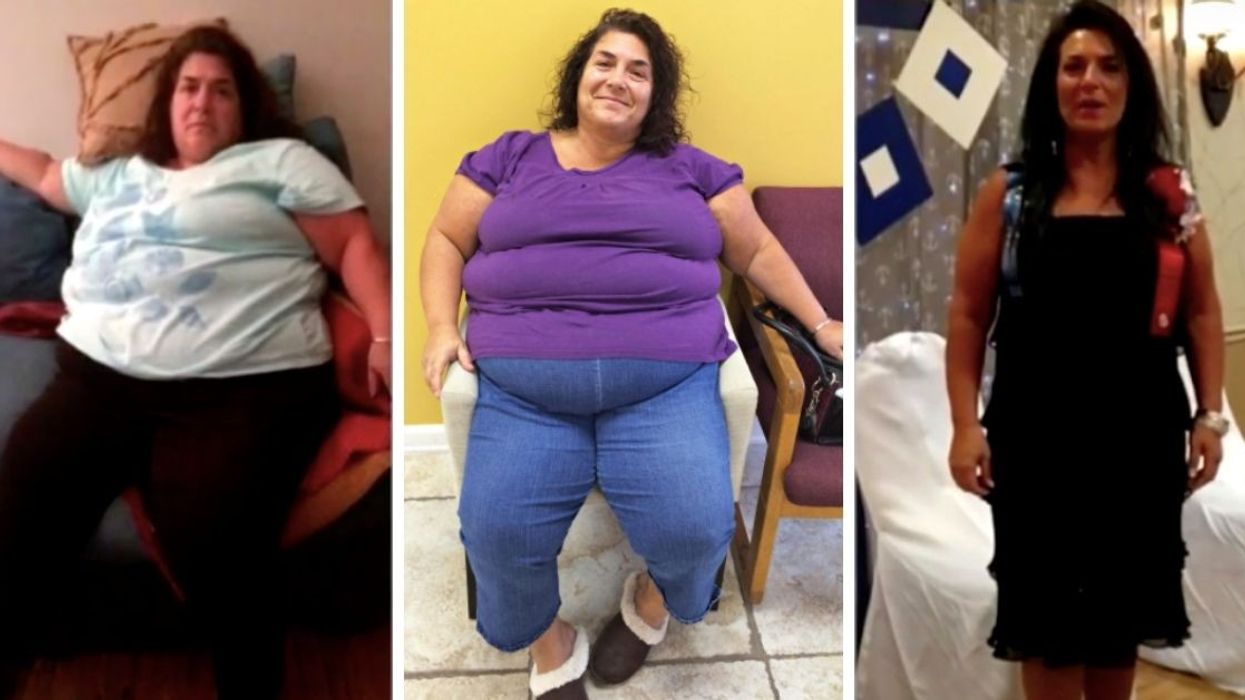 After Years Of Battling Her Weight, She Lost 189 Pounds And Turned Her Life Around