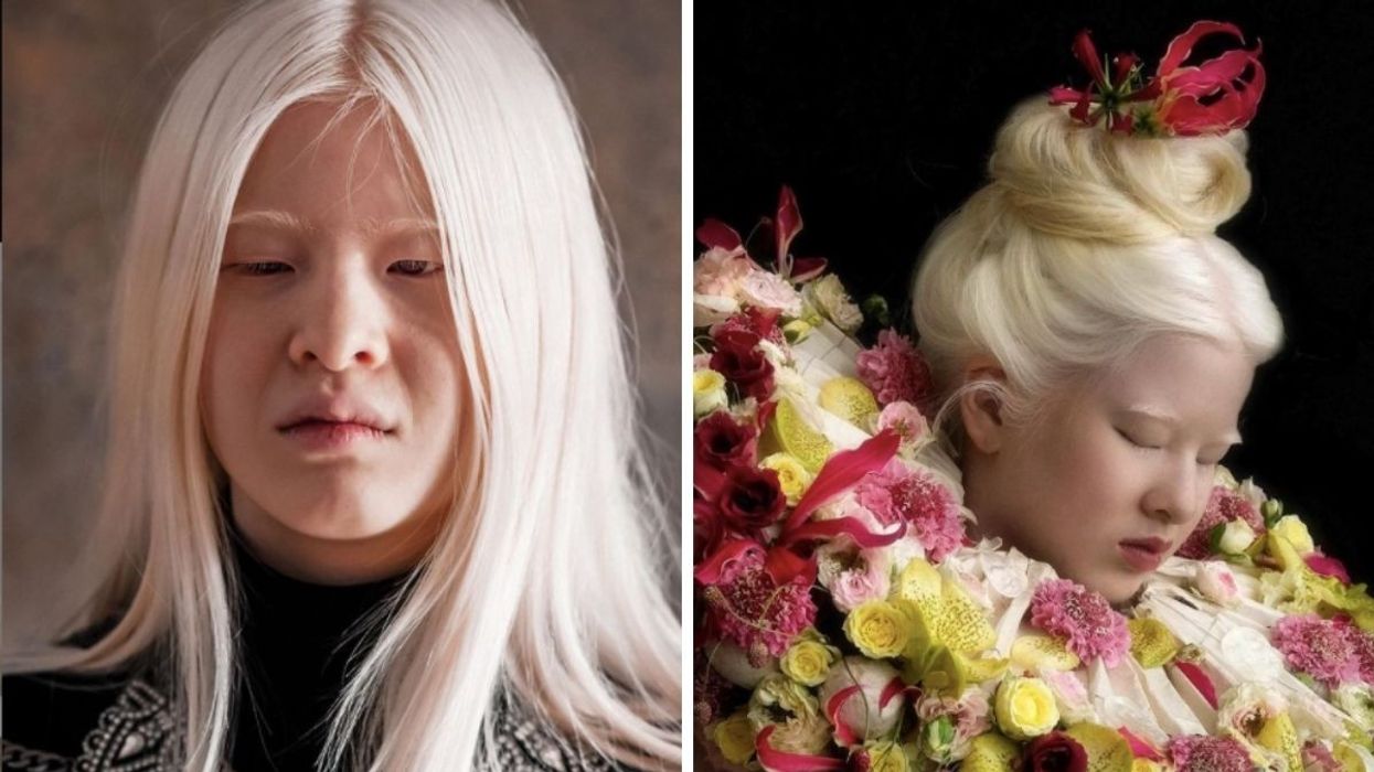 Abandoned By Parents, She Vows To Prove Them Wrong - Today, She Models For Vogue - Goalcast