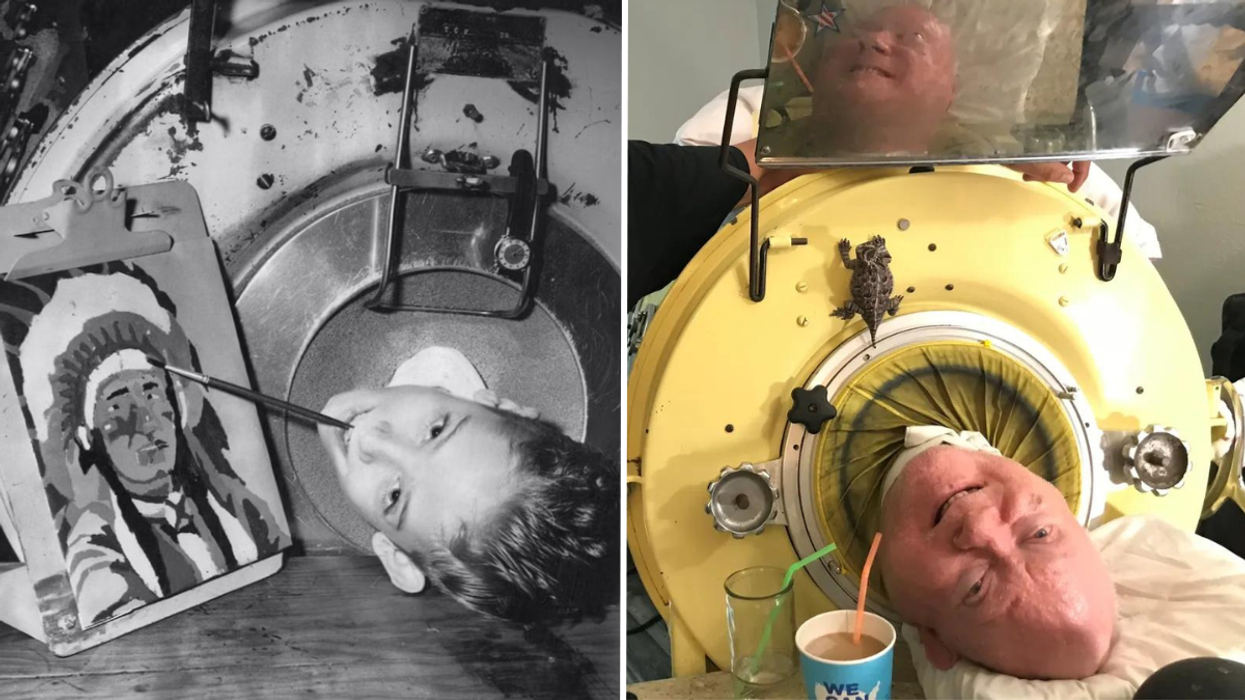 Man Has Spent 72 Years in an Iron Lung - Teaches Us How to Live a Full Life