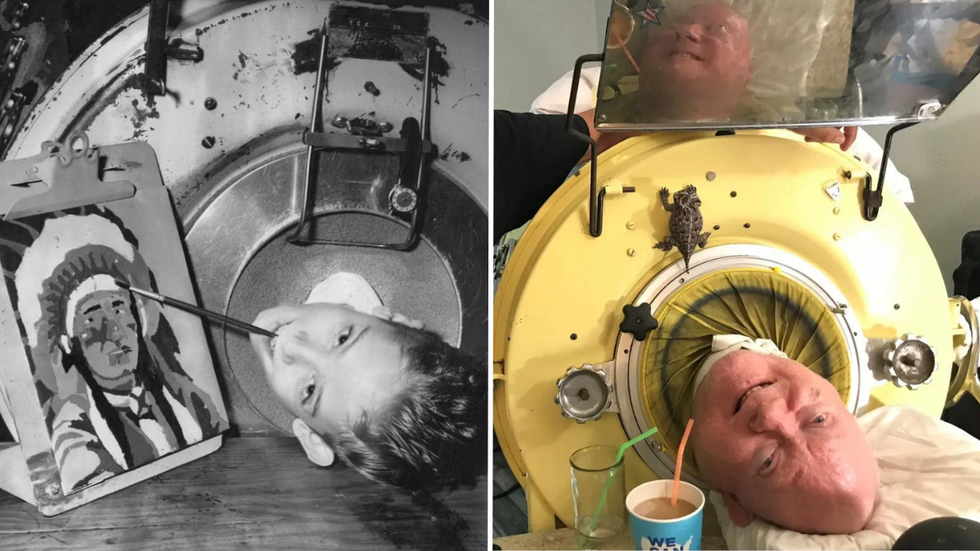 Man Has Spent 72 Years in an Iron Lung - Teaches Us How to Live a Full Life