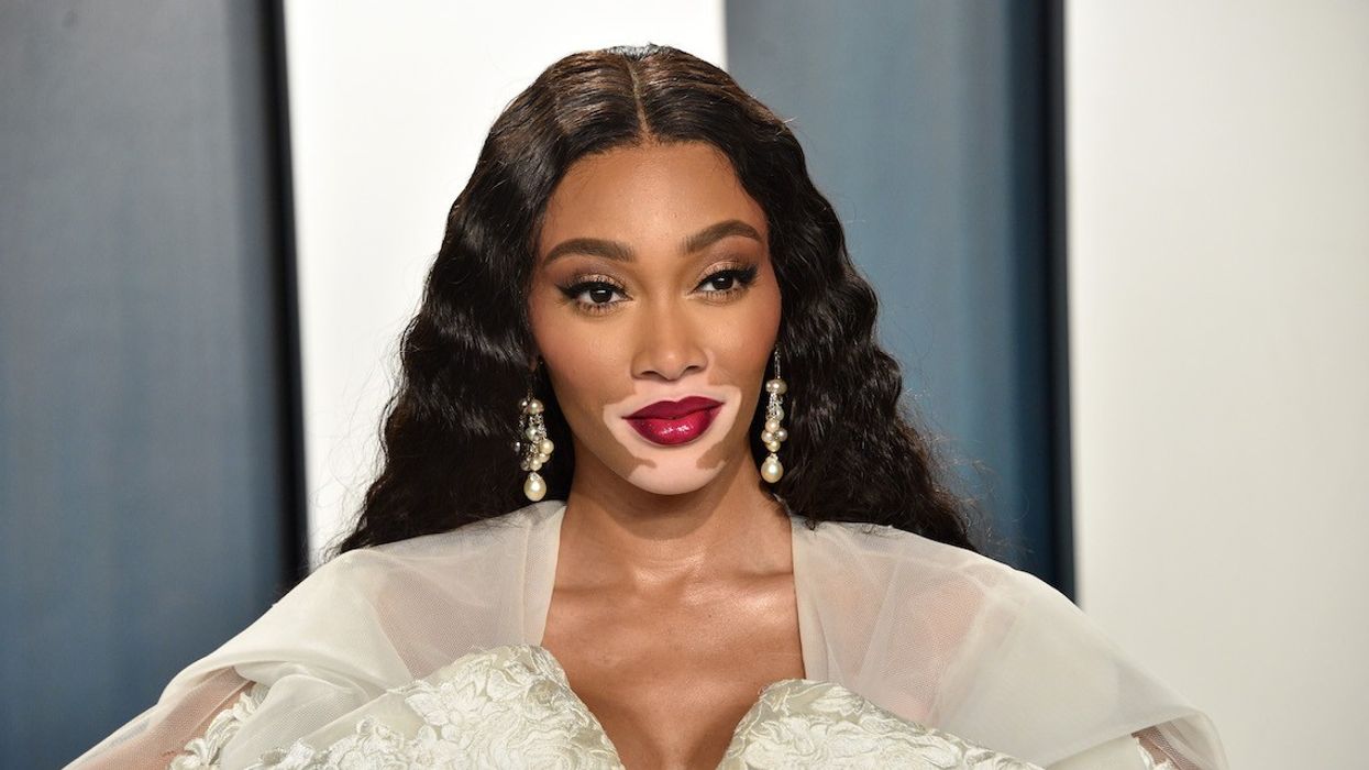 How Winnie Harlow Made It Despite Being Eliminated From America's Next Top Model