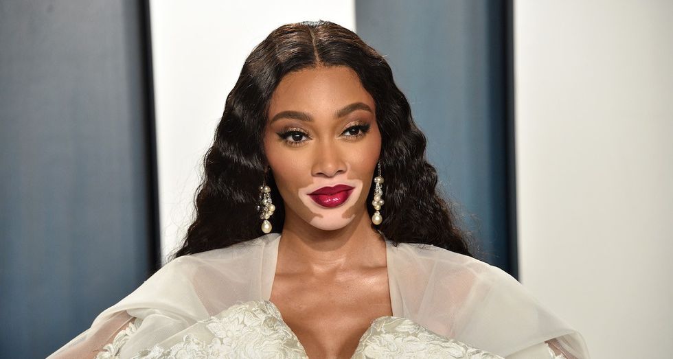 How Winnie Harlow Made It Despite Being Eliminated From America's Next Top Model