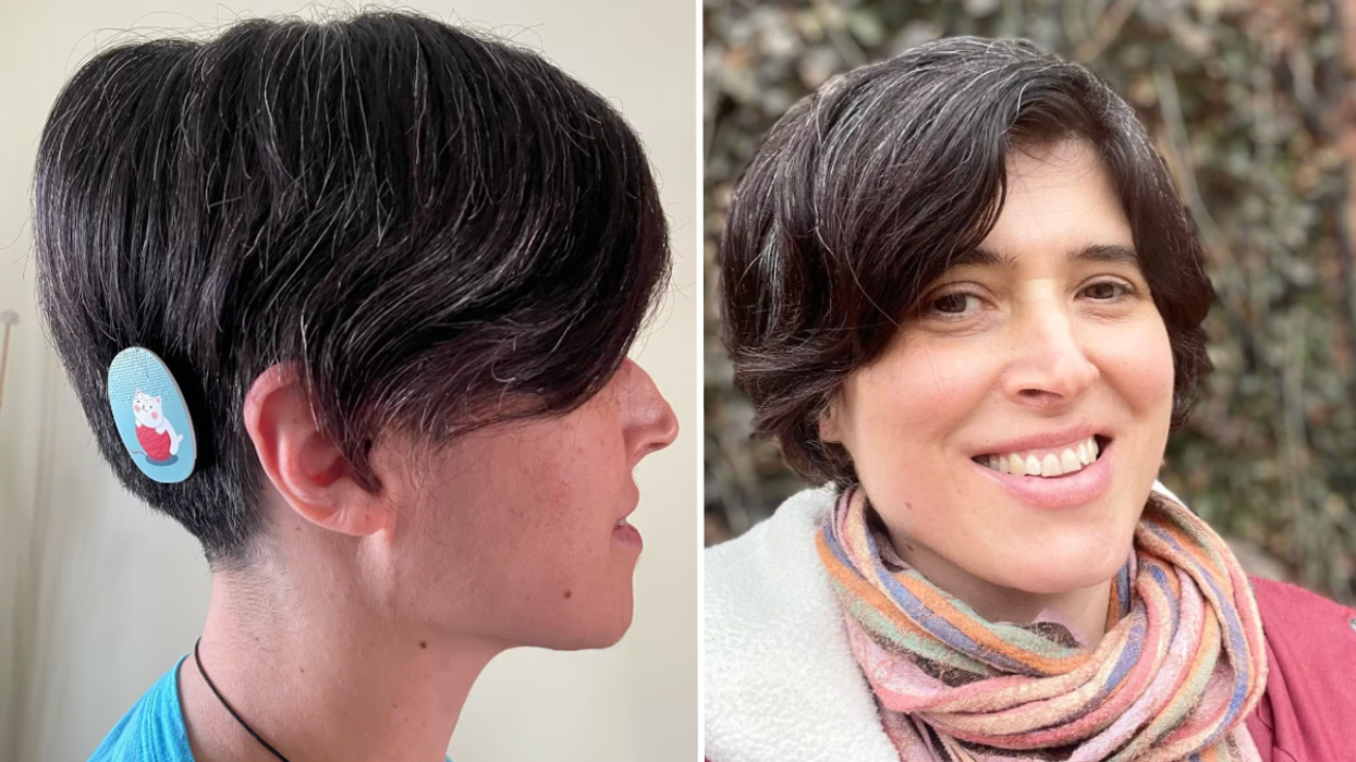 Woman Tried to Hide Her Hearing Aids - Until Her Son Inspired Her to Embrace Her Disability