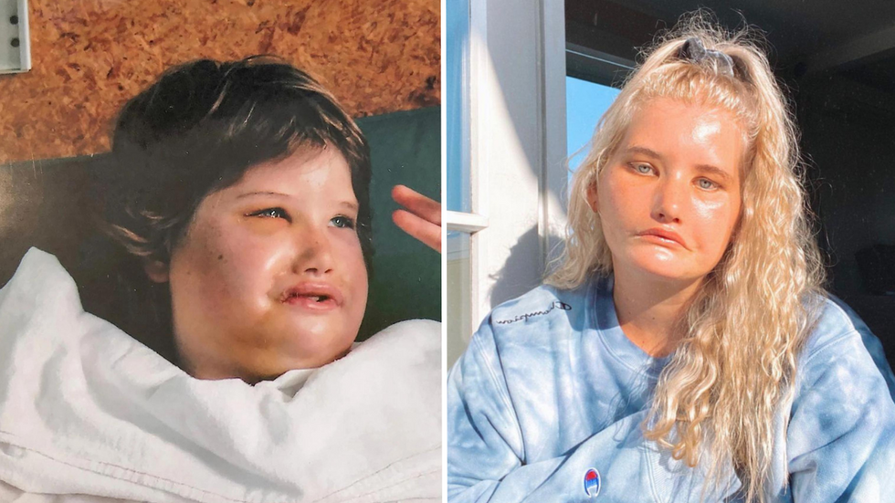 Girl Who ‘Can’t Smile’ Is Constantly Bullied by Classmates - Years Later, Proves Everyone Wrong and Becomes a Supermodel