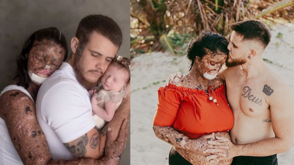 woman with rare skin condition hugging her husband and baby