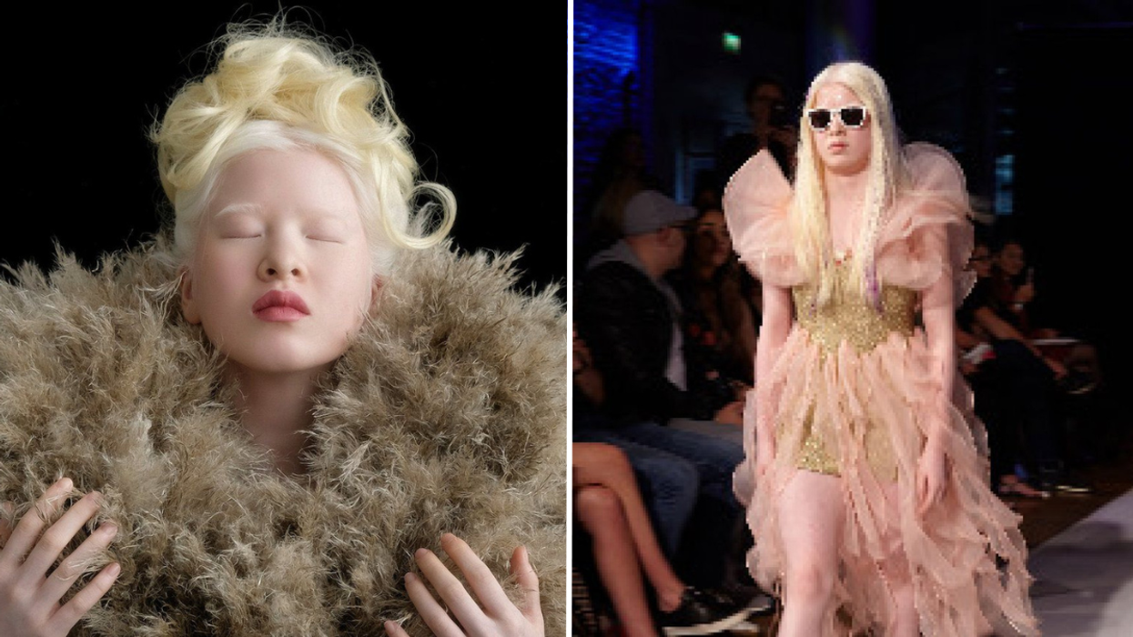 Parents Abandon Their Baby at an Orphanage Doorstep - After Vowing to Prove Them Wrong, She Now Models for Vogue