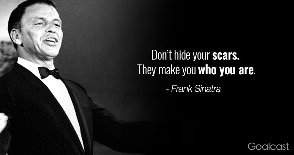 frank-sinatra-quote-scars-make-you-who-you-are