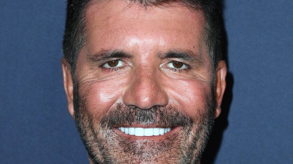 Simon Cowell smiling after botox surgery