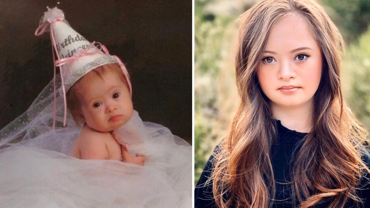 Doctors Wanted to Put Baby with Down Syndrome in an Institution – 15 Years Later, She Proves Them Wrong