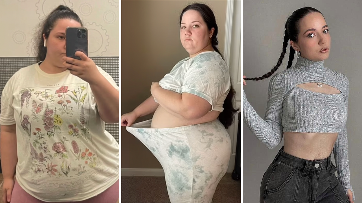 woman's before and after weight loss pictures