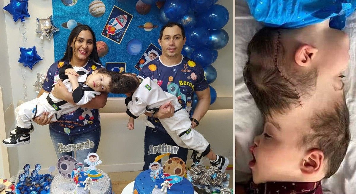 Family of 3-Year-Old Conjoined Twins Told Surgery Was Impossible — How They Defied Odds and Made Magic Happen