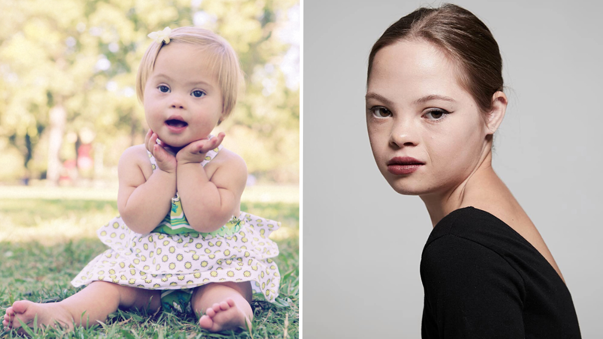 Parents Abandon Baby With Down Syndrome at Birth — Years Later, She’s a Famous Actor