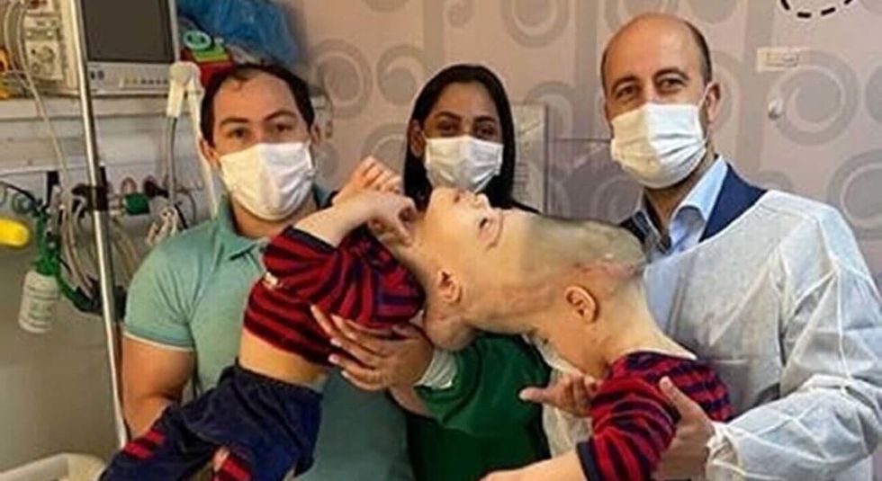 Conjoined Lima twins in the hospital before surgery