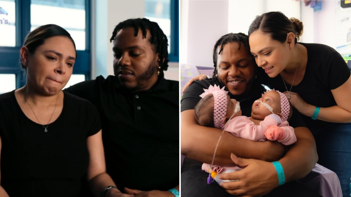 Formerly Conjoined Twins Finally Go Home After Spending Their First Half Year in the Hospital