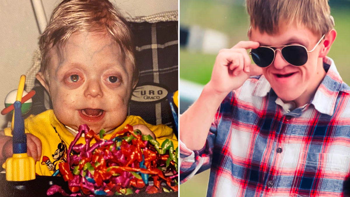 Doctors Predicted He Wouldn’t Live Past the Age of 2 — 18 Years Later, His Heroic Nurse Gives Him This Snazzy Photoshoot